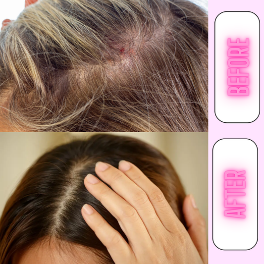 Red Light Scalp Massager Brush