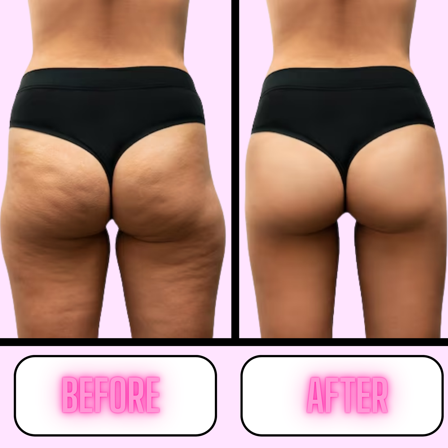 Anti Cellulite Massager